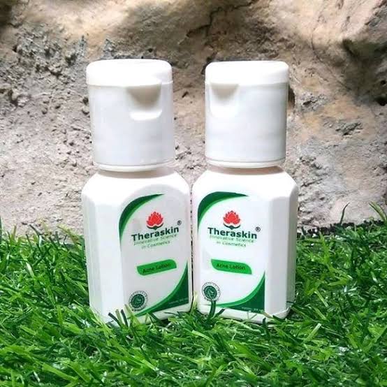 Acne Lotion Theraskin: Kandungan, Manfaat & Cara Pakai Acne Lotion Theraskin: Kandungan, Manfaat & Cara Pakai