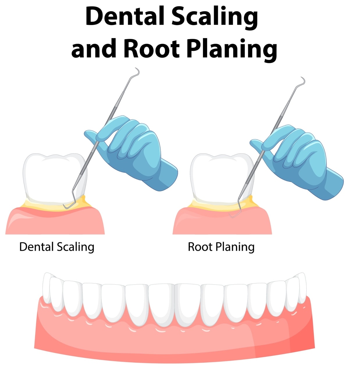 scaling