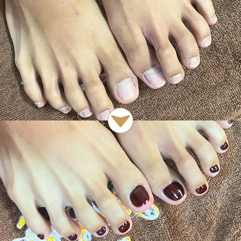 -