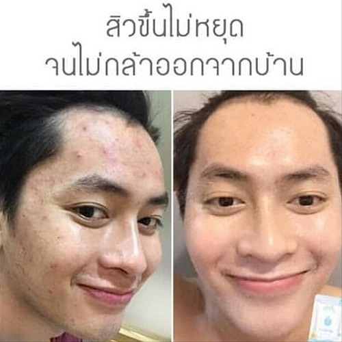 -