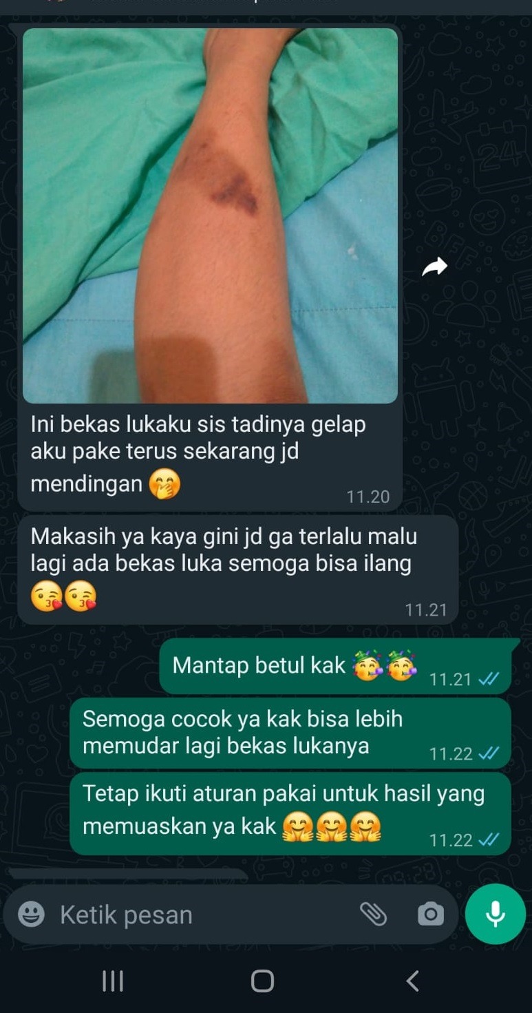 -