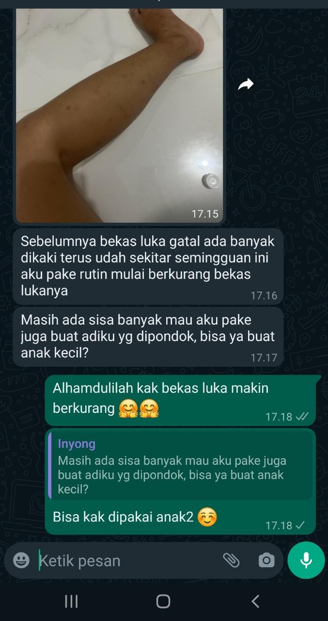 -