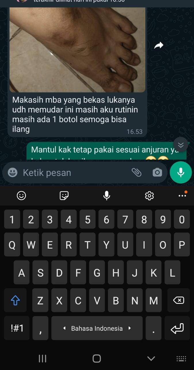 -