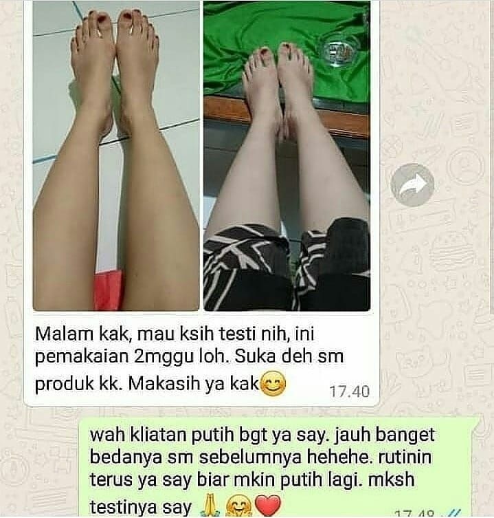 -