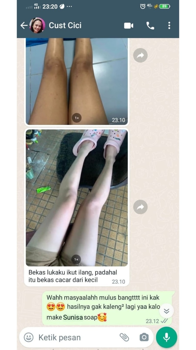-