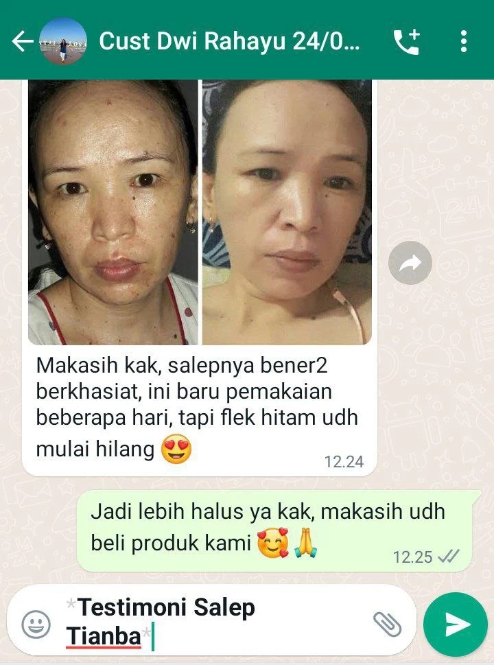 -