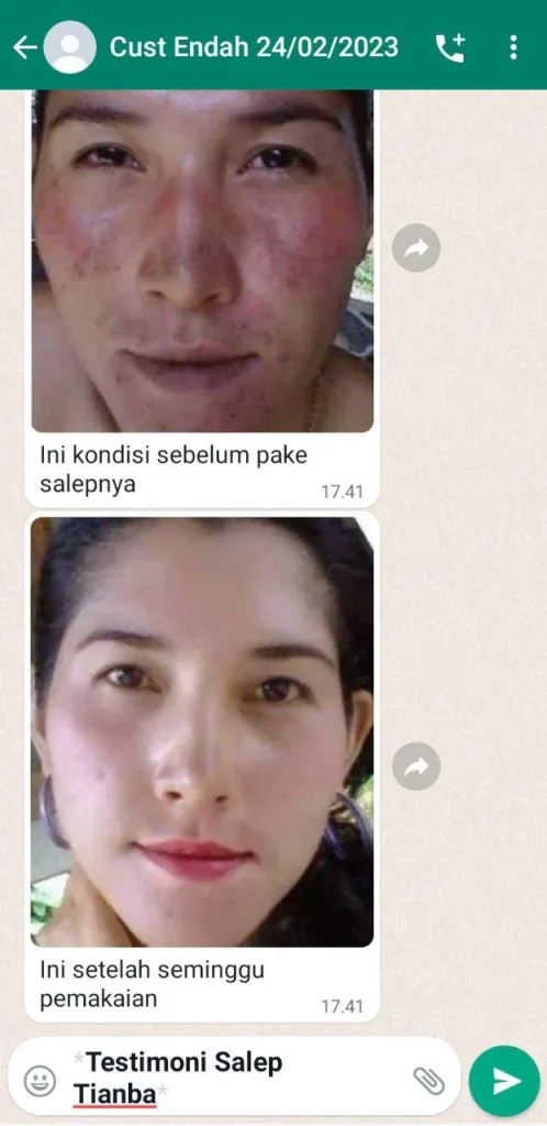 -